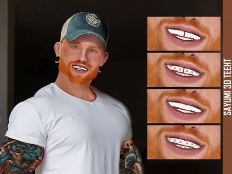 Cc Overlay, Grillz Teeth, Sims 4 Cc Eyes, The Sims 4 Skin, The Sims 4 Pc, Gold Grillz, Beauty App, Free Sims 4, Perfect Teeth