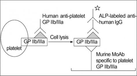 This is done by flow cytometric analysis for detection of lack of GpIb/IX in Bernanrd Soulier syndrome (deficiency of CD42), and lack of GpIIb/IIIa in Glanzmann’s thrombasthenia (deficiency of CD41, CD61).
 
What is the best protocol for platelet glycoprotein (GPIIb/IIIa) analysis using flow cytometry?
 

Fresh platelets should always be used. Storing platelets dramatically changes the level of transmembrane proteins. The best way is to follow one of standardized protocols defined Flow Cytometry, Always Be