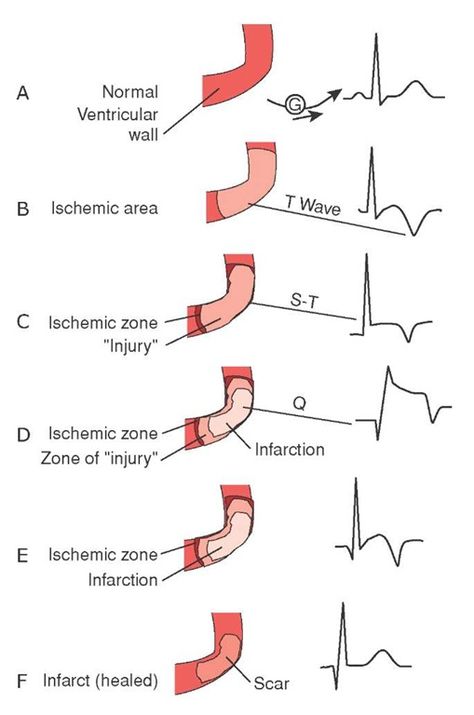 . Medical Diagrams, Paramedic School, Nursing Information, Penyakit Jantung, Cardiac Nursing, Nursing School Survival, Nursing School Studying, Nursing School Tips, Nursing School Notes