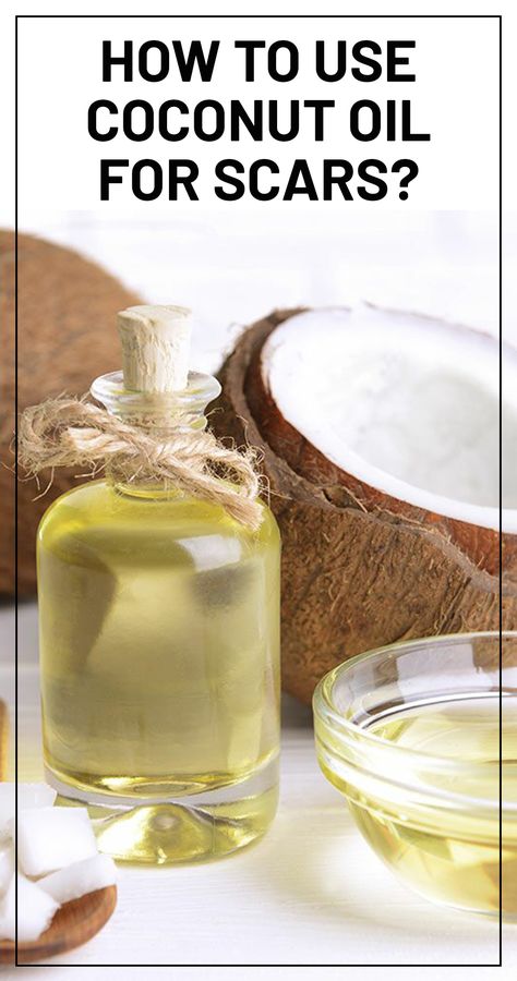 Does Coconut oil Help with Scars And How To Use It? How To Remove Scars On Legs Fast, Stretch Mark Cream Pregnancy, Whipped Coconut Oil, Getting Rid Of Scars, Scar Remedies, Oils For Scars, Scar Removal Cream, Scar Cream, Sick Remedies