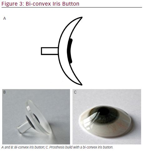 Ocular Prosthesis, Iris Painting, Sick Baby, Blank Slate, Levels Of Understanding, Parent Child Relationship, Medical Illustration, Hopes And Dreams, Pediatrics