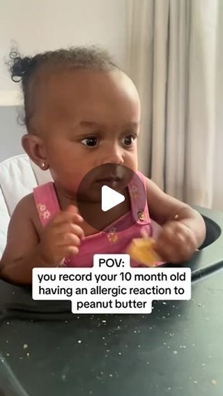 Cuteness Overload on Instagram: "Peanut Butter Allergy Awareness. Follow @bckcutie for more! -  🎥 @chelsthemama via TikTok  #Cutenessoverload #naturalhair  #cutiealert #babiesofinstagram #babyfever  #melanin #cute  #cutebabies #cutekids #bckcutie #blackbabies" Blaxican Babies, Babies Black, Biracial Babies, Allergy Awareness, Peanut Allergy, Black Babies, Good Parenting, Baby Fever, Cuteness Overload