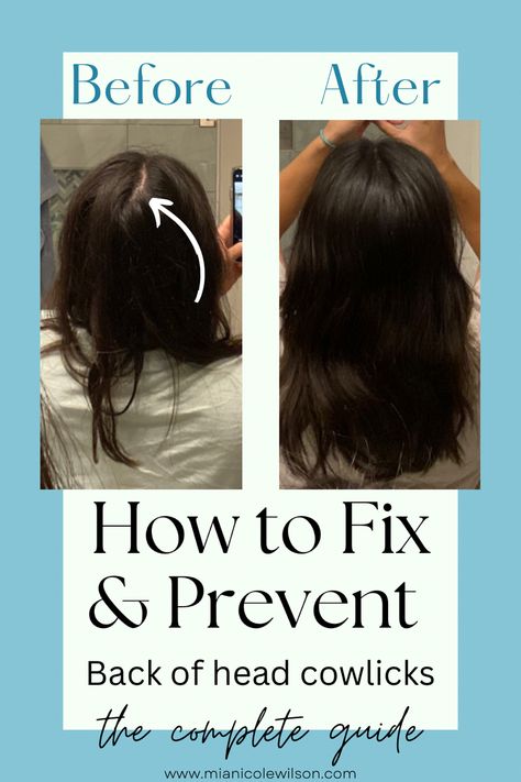 How to easily get rid of cowlicks in hair Cowlick Hairstyles, Hair Parts, Egyptian Hairstyles, Ugly Hair, Holographic Hair, Parting Hair, Gothic Hairstyles, Hair Fixing, Vintage Hair Combs