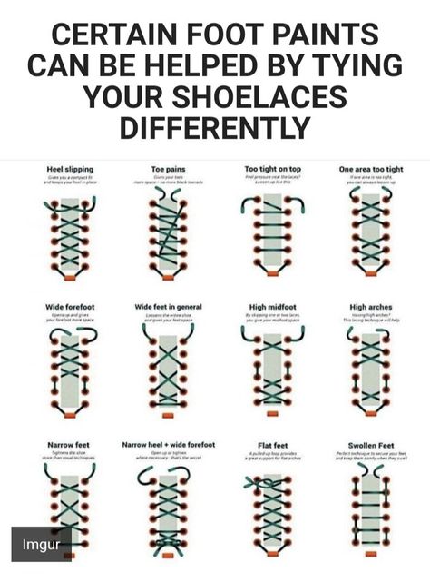 Shoe Laces Patterns, Planters Fasciitis, Shoe Tying, Tie Your Shoes, Shoe Lacing Techniques, Kt Tape, Ways To Lace Shoes, Shoe Lace Patterns Star, Star Shoe