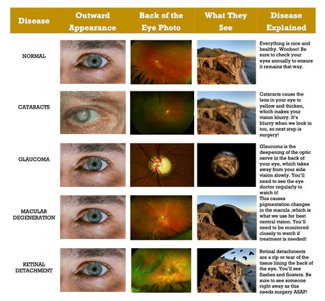 Opthalmic Technician, Optician Training, Eye Health Facts, Optometry Education, Eye Medicine, Optometry School, Eye Facts, Eye Anatomy, Medical Student Motivation