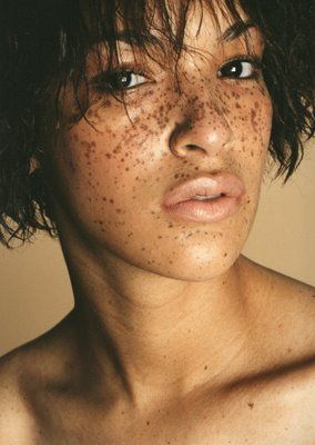 Freckles Aesthetic, Black Girls With Freckles, Beautiful Freckles, Freckles Girl, Freckle Face, Female Character Inspiration, 영감을 주는 캐릭터, Interesting Faces, Wedding Beauty