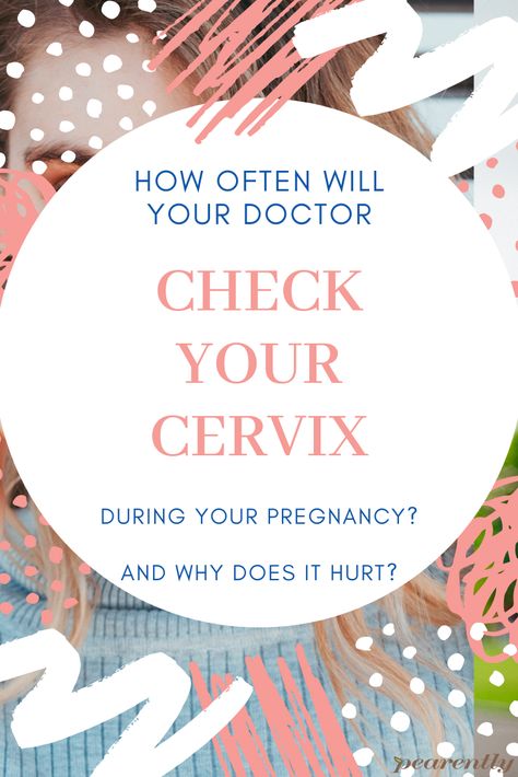 How often will my doctor check my cervix during pregnancy? This is a very common question. Not only is it important to understand how much and when your doctor will check your cervix, but also why your doctor is checking it!  Dr. Boyd, OB/GYN with 26+ years of clinical experience explains the importance of having your cervix checked. And should it be painful?  #cervixcheckpregnancy #cervicalexamsexplained How To Soften Your Cervix Natural Birth, How To Open Cervix Naturally, Soften Cervix For Labor, Mucus Plug, Birth Prep, Third Trimester Pregnancy, Pregnancy Pain, Preterm Labor, Female Health