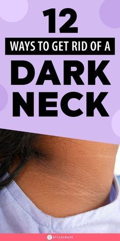 How To Get Rid Of Dark Neck: 13 Effective Home Remedies To Try How To Make Your Neck Lighter, Neck Hyperpigmentation, Dark Skin Around Neck, Dark Neck Remedies, Get Rid Of Dark Neck, Dark Neck, Detox Body, Wrinkle Remedies, Skin Advice