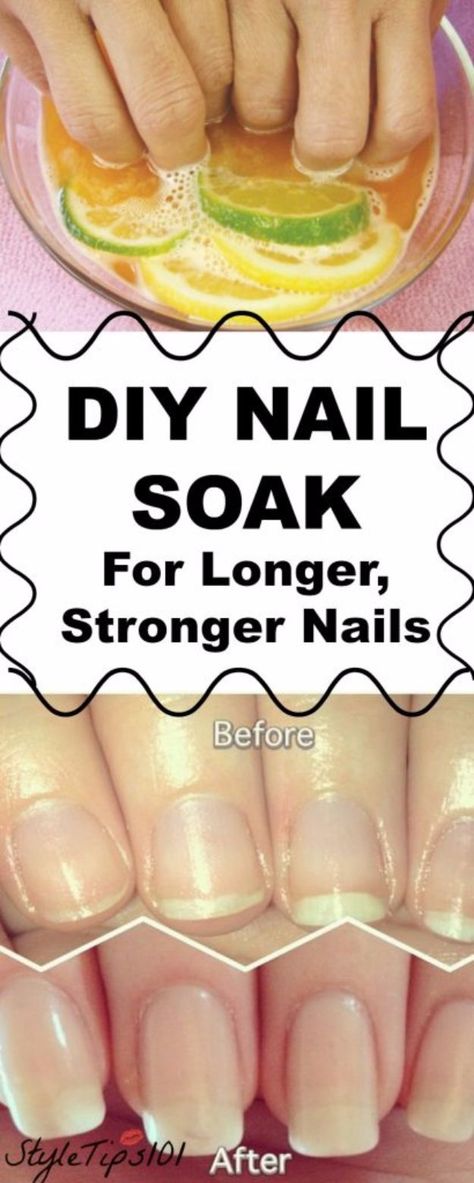 Diy Nail Soak, Do It Yourself Nails, Stronger Nails, Nail Soak, Nagel Tips, Nail Growth, Strong Nails, Healthy Nails, 3 Ingredient