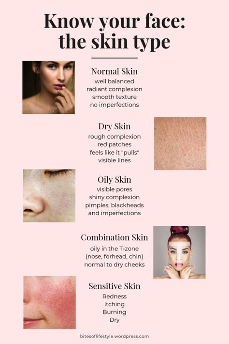 Know your face: a complete guide to skin types and phototypes – Bits of Life Skin Types Chart, Remove Skin Tags Naturally, Skin Facts, Skin Moles, Acne Overnight, Underarm Hair Removal, Natural Acne Remedies, Types Of Skin, Weight Workout