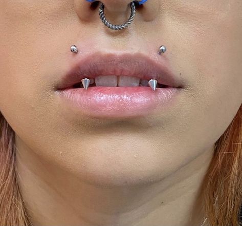 Angel Bites Piercing, Upper Lip Piercing, Mouth Piercings, Cool Ear Piercings, Face Piercings, Cool Piercings, Facial Piercings, Cute Piercings, Body Jewelry Piercing