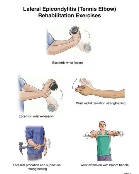 Tennis Elbow Stretches, Elbow Stretches, Tennis Elbow Exercises, Elbow Exercises, Rehab Exercises, Golfers Elbow, Rehabilitation Exercises, Wrist Exercises, Physiotherapy Clinic