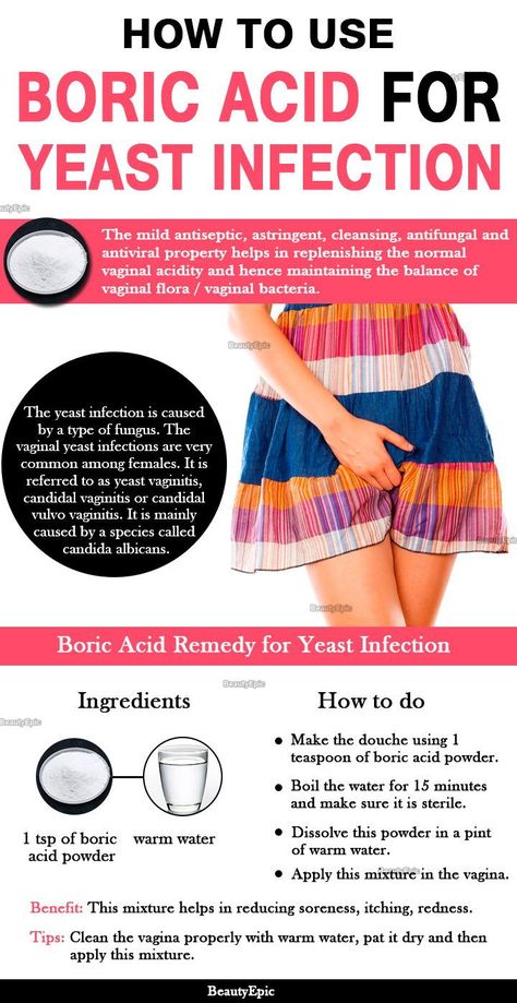 How to Treat Yeast Infection Using Boric Acid #YeastHomeRemedies Treat Yeast Infection, Yeast Infection Symptoms, Boric Acid, Yeast Infections, Candida Albicans, Health And Fitness Magazine, Daily Health Tips, Good Health Tips, Health And Fitness Tips