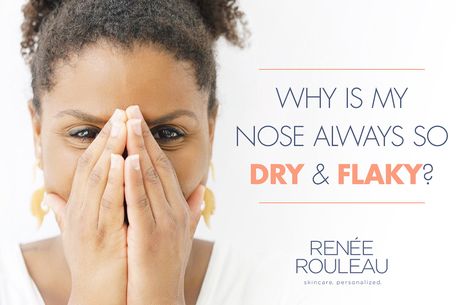 If your nose suffers from dryness, flaking or peeling skin, this article is for you. Learn how to treat dry skin on and around your nose and what causes it. Organic Skin Care Routine, Dry Nose, Newborn Schedule, Dry Skin Care Routine, Dry Skin On Face, Proper Skin Care, Dry Skin Patches, Peeling Skin, Dry Skin Care