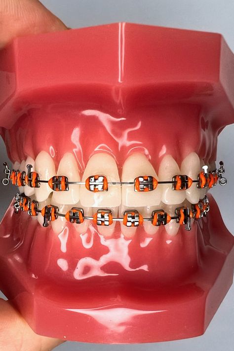 Embrace your inner fashionista with orange braces and learn how you can mix and match 9 stunning color combos that will brighten your smile. Discover the perfect blend of orange braces colors in this article. Braces Color Combo Ideas, Aesthetic Braces, Orange Braces, Brace Ideas, Braces Colours, Dental Braces Colors, Braces Colors Combinations, Red Braces, Braces Bands