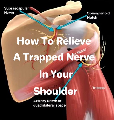 How to Relieve a Trapped Nerve in Your Shoulder | Patient's Lounge Pinched Nerve In Shoulder, Shoulder Pain Remedies, Pinched Nerve In Neck, Trapped Nerve, Neck Pain Exercises, Shoulder Pain Exercises, Neck And Shoulder Exercises, Shoulder Impingement, Pain Relief Remedies