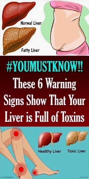 Natural Add Remedies, Skin Breaking Out, Women Health, Liver Detox, Excessive Sweating, Healthy Liver, Cardio Gym, Liver Health, Diet Keto