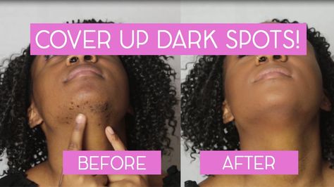 Color Correction Makeup Tutorials, Makeup Tutorial For Black Women, Corrective Makeup, American Makeup, Hyper Pigmentation, Ideas For Makeup, Beauty Marks, Makeup Tutorial Foundation, Dark Spots On Face