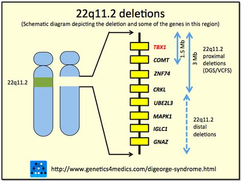 Most people with 22q11.2 deletion syndrome are missing a sequence of about 3 million DNA building blocks (base pairs) on one copy of chromosome 22 in each cell. This region contains 30 to 40 genes, many of which have not been well characterized. A small percentage of affected individuals have shorter deletions in the same region. This condition is described as a contiguous gene deletion syndrome because it results from the loss of many genes that are close together. 22q Deletion Syndrome, Cri Du Chat Syndrome, Digeorge Syndrome, Prader Willi Syndrome, Nurse Things, Case Presentation, Chd Awareness, Genetic Diseases, Piano Playing