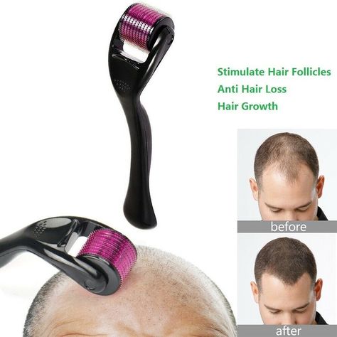 your hair Micro Needle Roller, Micro Needle, Stimulate Hair Follicles, Scalp Serum, Hair Lotion, New Hair Growth, Beard Growth, Derma Roller, Skin Therapy