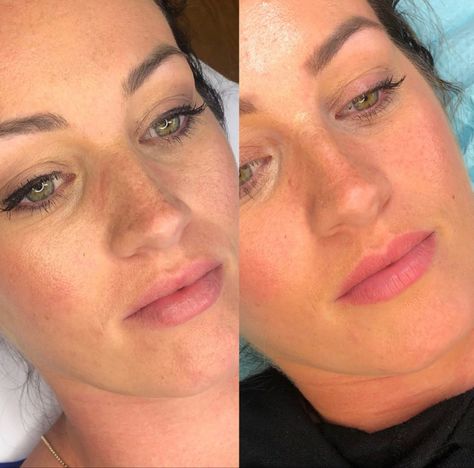 Before and after lip blush tattoo results. Lasts 3-5 years. Lip Blushing Tattoo Before And After, Lip Blushing Tattoo, Lip Blush Tattoo, Blush Tattoo, Face Essentials, Lip Blushing, Cosmetic Tattooing, Lip Blush, Painted Faces