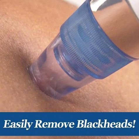 Suck the yuck out of your pores with our painless and efficient blackhead removal tool. It’s like a cordless vacuum for your face! Reveal your beautiful skin. Facial Machines, Neutral Skin, Removes Blackheads, Pore Vacuum, Pimples Under The Skin, Black Head Remover Mask, Blackhead Remover Tool, Blackheads On Nose, Pore Cleaner