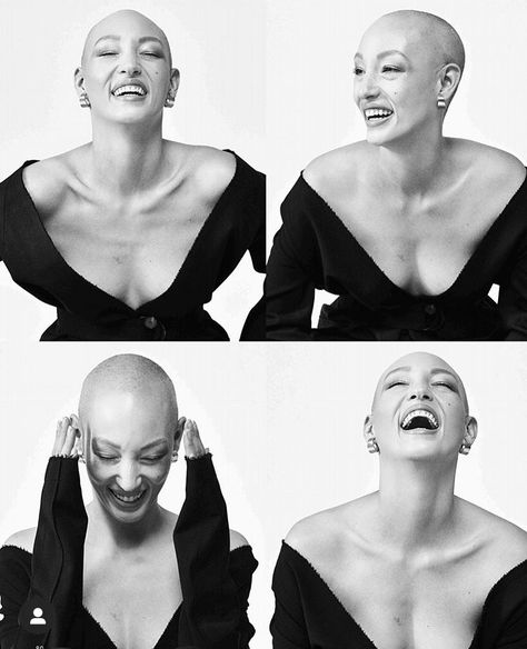 Alopecia Photo Shoot, Bald Model Photoshoot, Bald Head Photoshoot, Bald Woman Portrait, Bald Women Photoshoot, Bald Woman Photoshoot, Shaved Head Women Photoshoot, Alopecia Photography, Bald Photoshoot Ideas