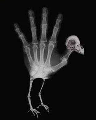 Xray Humor, Hand Print Art, Radiology Humor, Rad Tech Week, Hand Turkey, Radiologic Technology, Xray Art, Dental Jokes, Radiology Tech