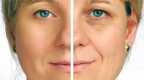 Sallow Skin: Causes, Remedies, and More Sallow Skin, Creme Anti Age, Anti Aging Creme, Anti Aging Wrinkles, Anti Aging Beauty, Anti Aging Face, Anti Wrinkle Cream, Wrinkle Cream, Best Anti Aging