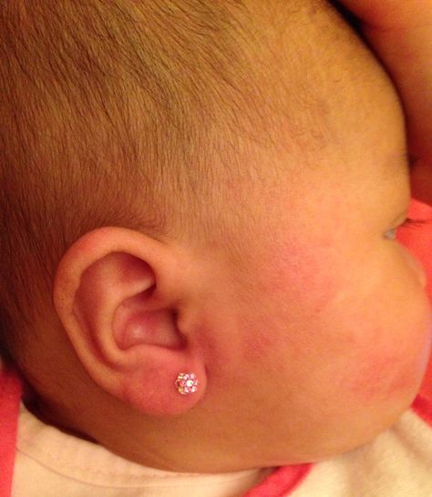 4 months old wearing Blomdahl medical-grade plastic earrings. Piercing by Rachel Smith, RN Tragus Stud Piercing, Baby Ear Piercing, Ear Piercing Studs, Ear Piercings Chart, Rachel Smith, Gold Ear Jacket, 4 Months Old, Peridot Color, Baby Earrings