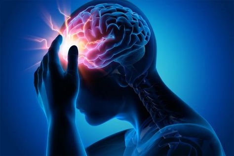 Signs a Migraine Is Coming Migraine Pain, Migraine Attack, Headache Types, Migraine Prevention, Severe Headache, Migraine Headaches, Formda Kal, Sciatica, Neck Pain