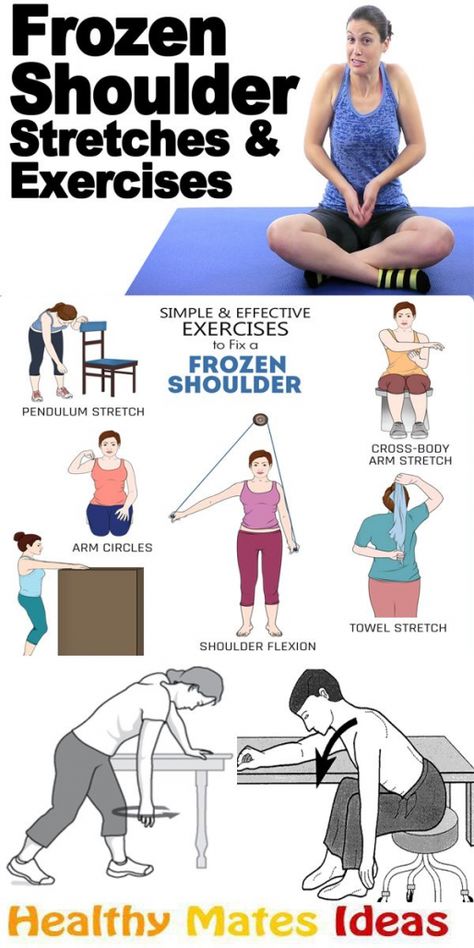 Simple and Effective Exercises to Fix a Frozen Shoulder! mobility exercises workout plans #Mobilityexercises Frozen Shoulder Exercises, Shoulder Mobility Exercises, Shoulder Rehab Exercises, Forward Head Posture Exercises, Rotator Cuff Exercises, Shoulder Pain Exercises, Neck And Shoulder Exercises, Shoulder Rehab, Shoulder Stretches