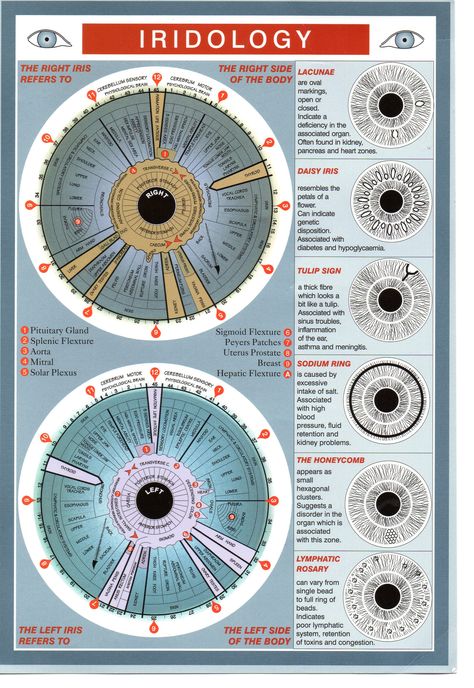 Iridology Chart, Health Chart, Health Heal, Alternative Healing, Naturopathy, For Eyes, Alternative Health, Reflexology, Eye Health