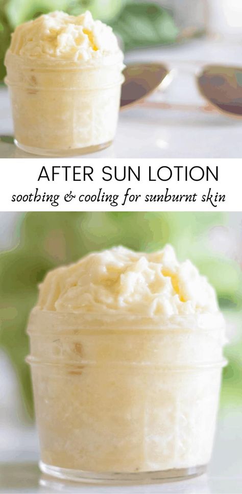 Sunburn Cream, How To Treat Sunburn, After Sun Lotion, Diy Lotion, Diy Kosmetik, Homemade Lotion, Sun Lotion, After Sun, Homemade Remedies