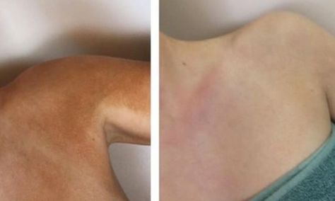 How To Fix Self Tanner Mistakes, Remove Self Tanner From Hands, Self Tanner Remover Diy, Remove Self Tanner From Skin, How To Remove Self Tanner From Skin, How To Remove Self Tanner From Hands, How To Remove Self Tanner, Coco And Eve Self Tanner, Diy Self Tanner