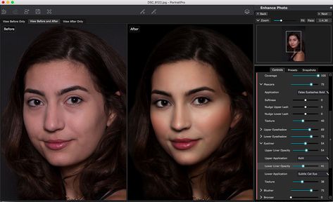 The 10 Best Photoshop Plugins for 2020 | CloudApp Photoshop Keyboard, Face Sweating, Pimples On Face, Retouching Photoshop, Change Hair, Altered Photo, Acne Problem, Affinity Photo, Photoshop Plugins