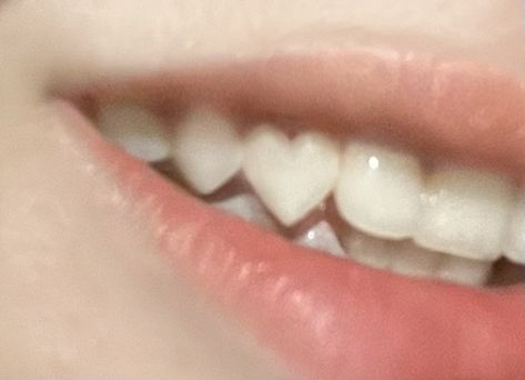 Loose Teeth, Teeth Aesthetic, Pretty Teeth, Canine Tooth, Loose Tooth, Lucet, Perfect Teeth, Vampire Teeth, Tooth Gem