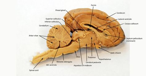 Brain Anatomy Diagram, Brain Parts And Functions, Biological Psychology, Human Brain Diagram Anatomy, Sheep Brain Dissection Anatomy, Human Brain Diagram, Structure Of Human Brain, Fetal Pig Dissection Anatomy, Anatomy Lab