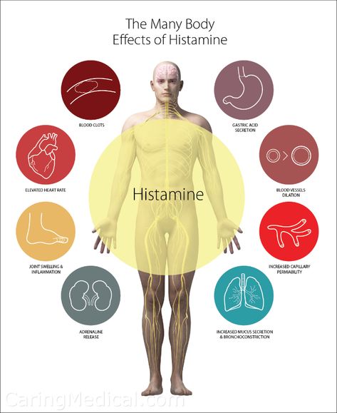 Vagas Nerve, Vagus Nerve Damage, Histamine Intolerance Symptoms, Transverse Myelitis, Chronic Hives, Mast Cell Activation, Ehlers Danlos Syndrome Awareness, Enteric Nervous System, The Vagus Nerve