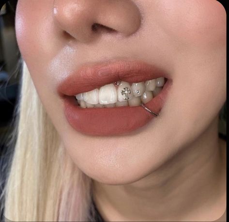 Tooth Gems Aesthetic, Teeth Gems, Pretty Teeth, Dental Jewelry, Tooth Jewelry, Grillz Teeth, Windows To The Soul, Diamond Teeth, Tooth Gems