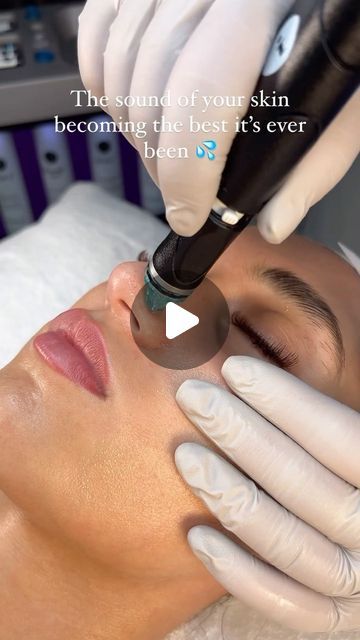 Hydrafacial on Instagram: "The most satisfying sound knowing your pores are being vacuum cleaned ���🤩 #hydrafacial #asmrskincare" Pore Vacuum Videos, Facial Benefits, Skin Recipes, Hydra Facial, Most Satisfying, Skin Food, Clean Skin, Hair Skin, Knowing You