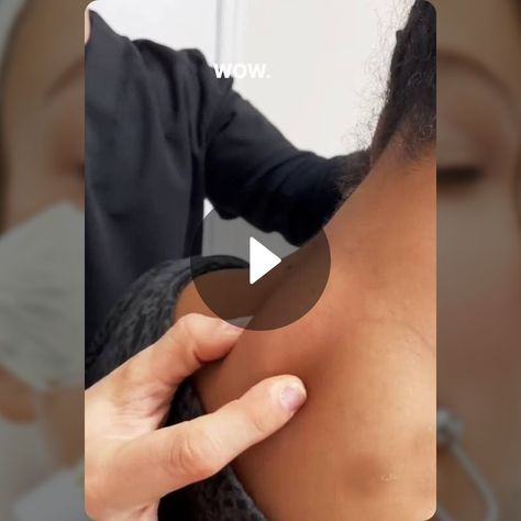 So Satisfying👉👃👈 - Dermatology | Snapchat Neck Pimples, Cystic Pimple, Best Snapchat, So Satisfying, Consumer Health, Dermatology, Snapchat, Beauty