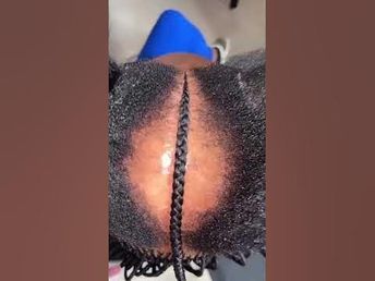 Braids To Cover Bald Spot, Braids For Women With Alopecia, Braids For Alopecia For Black Women, Alopecia Braid Styles, Braids For Alopecia, Single Braids For Black Women, Canerow Hairstyles, Alopecia Hairstyles Black Women, Hairstyles To Cover Bald Spots