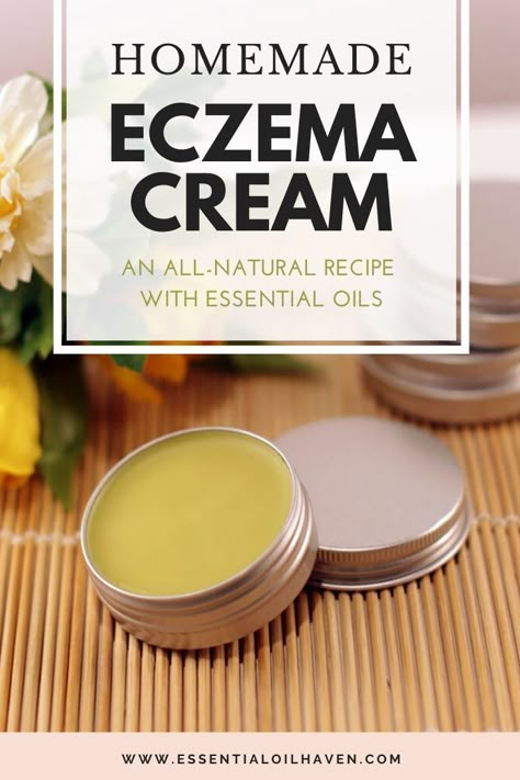 Homemade Eczema Cream Recipe using Essential Oils and all natural ingredients. #eczemacream #allnatural #essentialoils #essentialoilhaven Excema Remedies Diy, Manuka Essential Oil, Healing Salve, Salve Recipes, Herbal Salves, Diy Cream, Healing Salves, Natural Healing Remedies, Healing Remedies