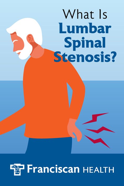 Stenosis Of The Spine, Stenosis Exercises, Sciatic Nerve Stretches, Nerve Anatomy, Human Body Facts, Spinal Fusion, Piriformis Syndrome, Spinal Nerve, Pinched Nerve