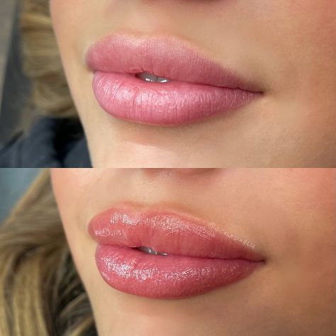 This before and after lip tattoo 🤍 One of my favorite lip sessions using @permablend_pigments Tender Carmel (RIP because I’m pretty sure this color has been discontinued 😢) This client had a beautiful, natural pink hue to their lips that a lot of people desire when getting their lip blush done. 🎀 We wanted to stick close to the lips natural shade, but enhance the color by adding a warm, nude touch. Adding the touch of warmth really helped define the lip shape and complement the clients feat... Lip Blushing Tattoo Before And After, Lip Blushing Tattoo Colors, 2025 Manifestation, Honey Makeup, Lip Permanent Makeup, Pretty Poison, Lip Blushing, Lips Tattoo, Peach Lips