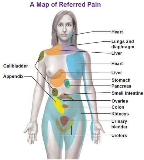 Referred Pain, Nursing Tips, Medical Knowledge, Medical Information, Anatomy And Physiology, Female Body, The Human Body, Health Info, Massage Therapy