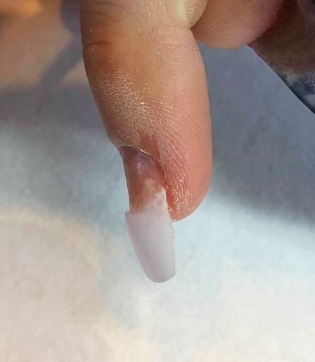 How to Correct Ski Jump Nails - Technique - NAILS Magazine Ski Nails, Ski Jump, Nail Coat, Ski Slope, Nail Techniques, Nail Repair, Ski Jumping, Nail Plate, Types Of Nails