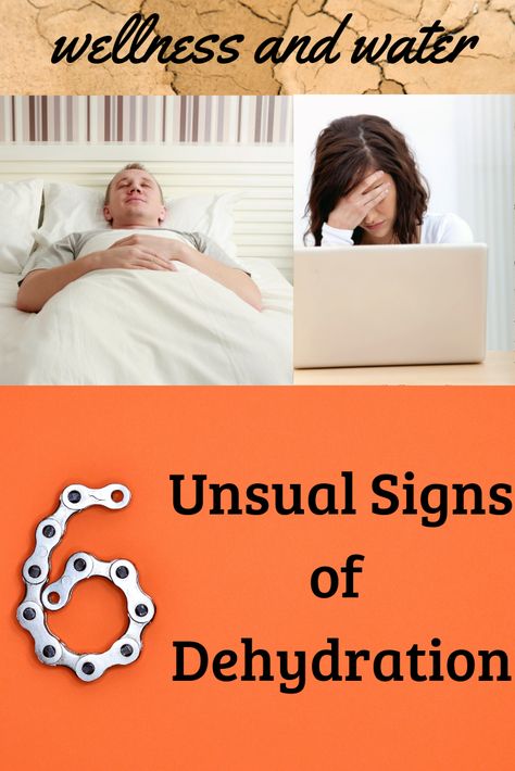Clearly, severe dehydration must be treated promptly, but even mild dehydration can have adverse effects on mood and energy. It’s important to catch any degree of dehydration early, but the signs of dehydration aren’t always obvious ones like thirst and fatigue.#hydration|#water|#xooma Dehydration Remedies, Symptoms Of Dehydration, Dehydration Symptoms, Water Health Benefits, Increase Height Exercise, Hydration Water, Signs Of Dehydration, Healthy Lifestyle Quotes, Learn Yoga