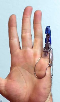 Prosthetic Fingers, Prosthetic Device, Orthotics And Prosthetics, Medical Tech, Biomedical Engineering, Future Tech, Medical Technology, Mechanical Design, Cool Tech